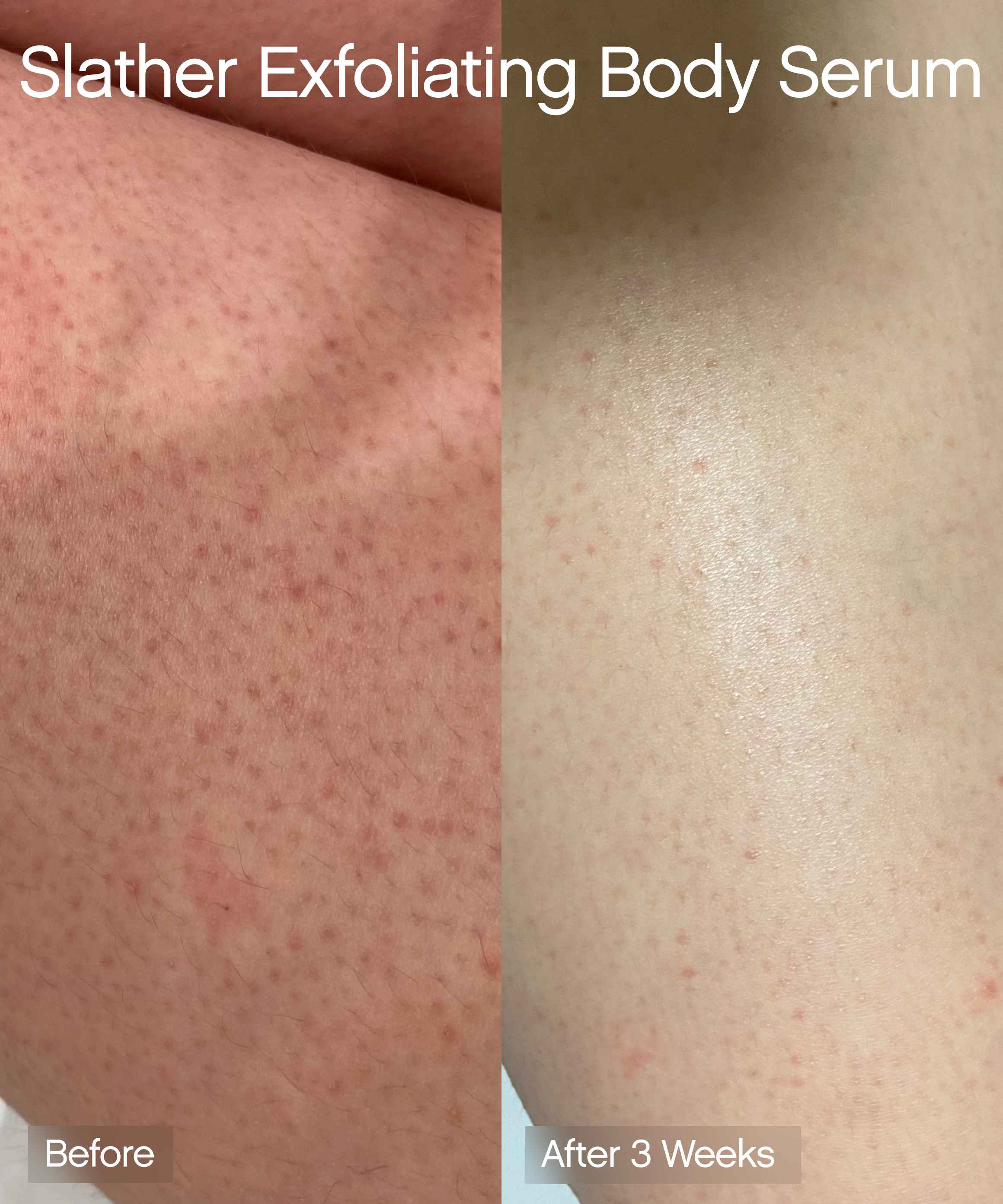 Exfoliating Body Duo